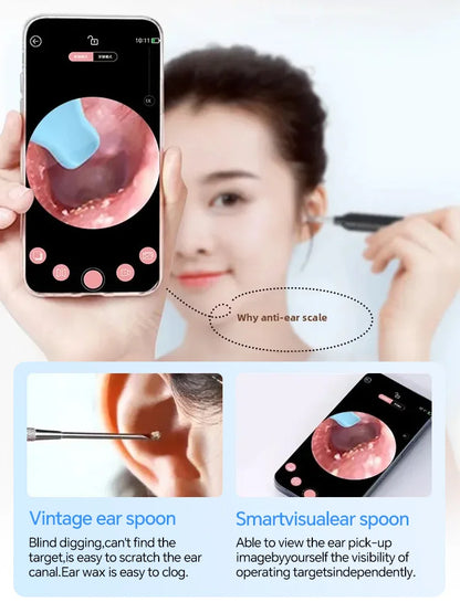 Generation-2, Visual Ear Wax Cleaner Camera Safe Earwax Removal Endoscope Ear Cleaning Tools Ear Care, Black, White Styles, Hot